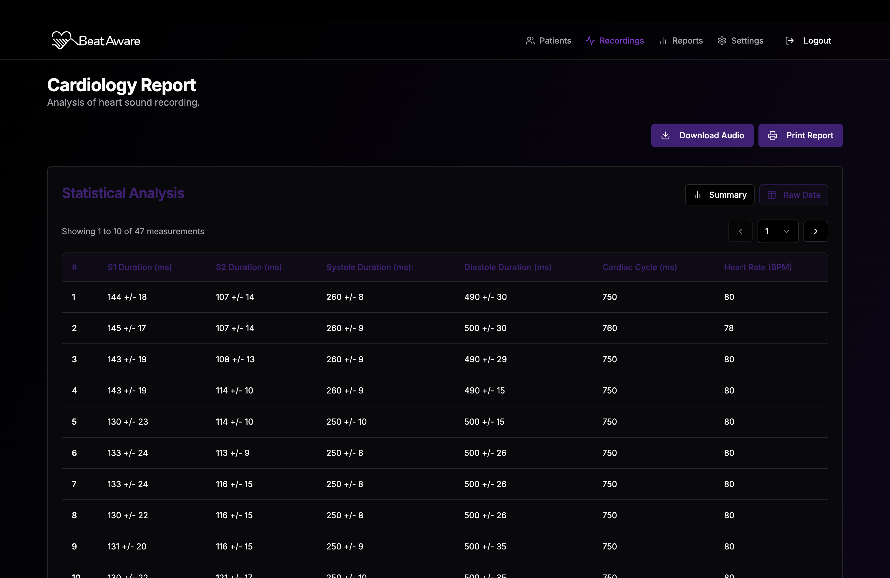 Detailed table view of heart sound measurements with multiple data points